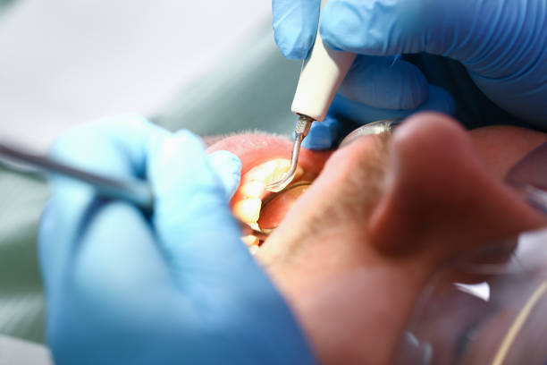 Best Urgent Tooth Repair  in Tickfaw, LA