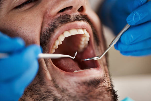 Emergency Dentist Open Today in LA