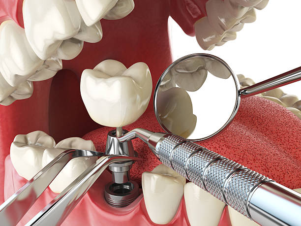 Best Emergency Gum Pain Relief  in Tickfaw, LA