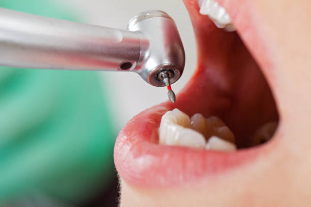 Best Cracked Tooth Emergency Dentist  in Tickfaw, LA
